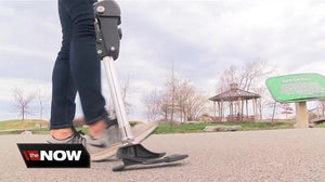 Buffalo prosthetic company helping amputees to walk with confidence
